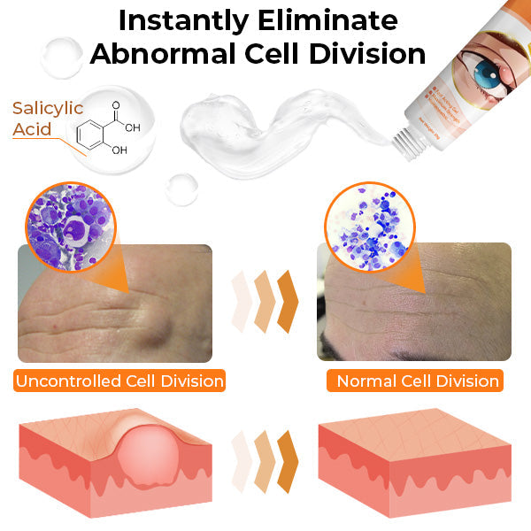 GFOUK™ MediSmooth Tags & Lumps Remove Gel