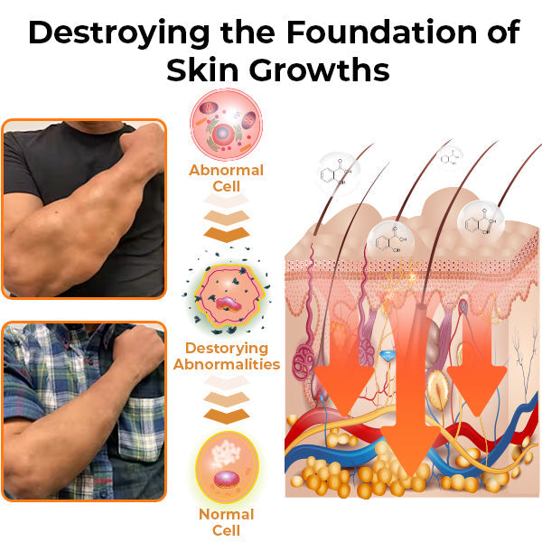 GFOUK™ MediSmooth Tags & Lumps Remove Gel